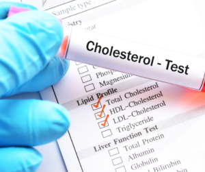 Hypothyroid people often will develop high cholesterol.  Stay on top of your thyroid health with detailed NMR testing.